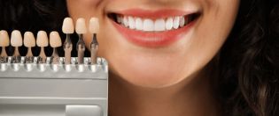 Crown Bridges Service